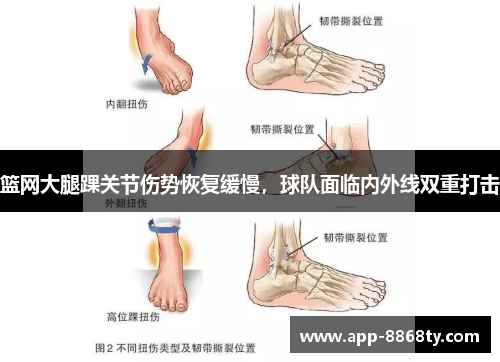 篮网大腿踝关节伤势恢复缓慢，球队面临内外线双重打击